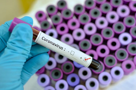 How coronavirus ranks on the worldwide death toll