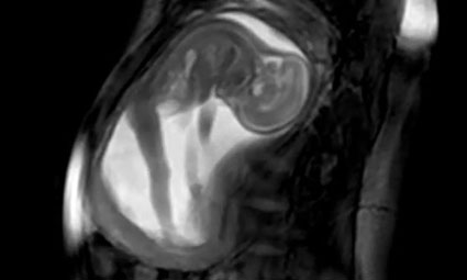 Just a ‘clump of cells’? Amazing footage shows baby at 20 weeks gestation